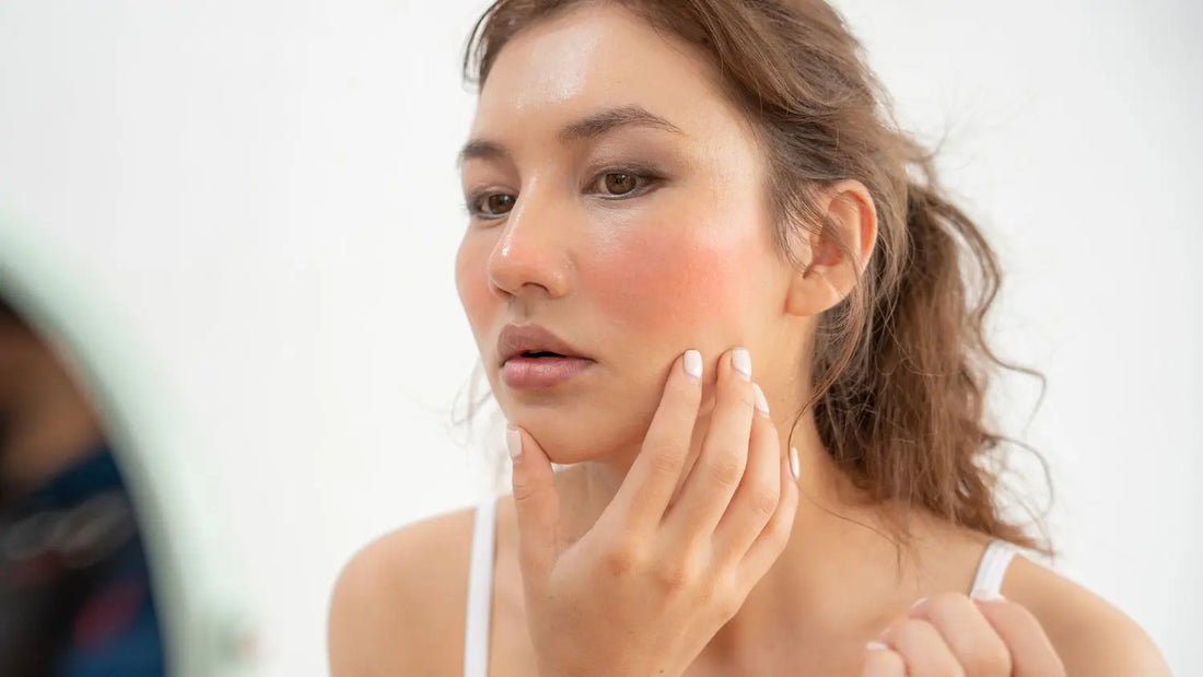 What causes skin redness, and what can you do about it?