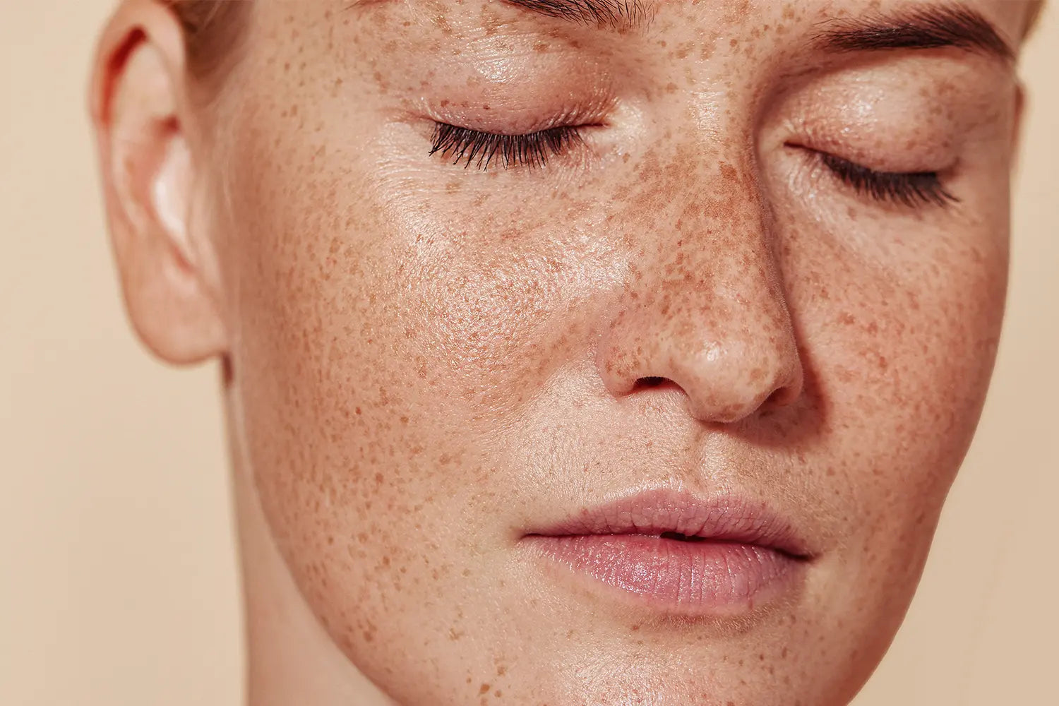Close-up of a person's face with freckles on a beige background